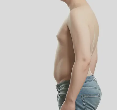 마른 비만의 개념을 시각적으로 표현한 이미지