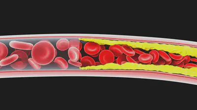 혈액순환 안될때의 주범, 혈관 건강의 중요성