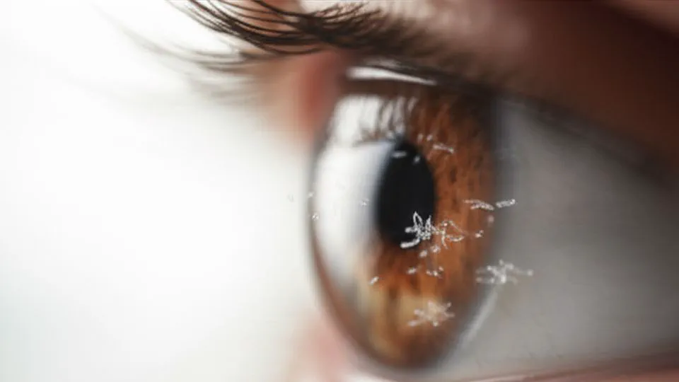 비문증, 괜찮다고 방치하면 안 됩니다 (놓치면 후회할 위험 신호)