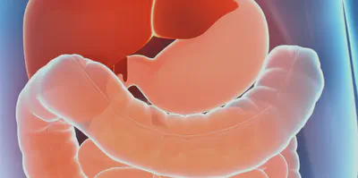 알긴산나트륨액의 위장 보호 원리