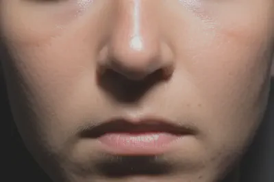 간과하기 쉬운 전해질 부족 증상