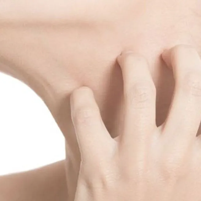 긁지 말고 바르세요, 민감성 피부 탈출기