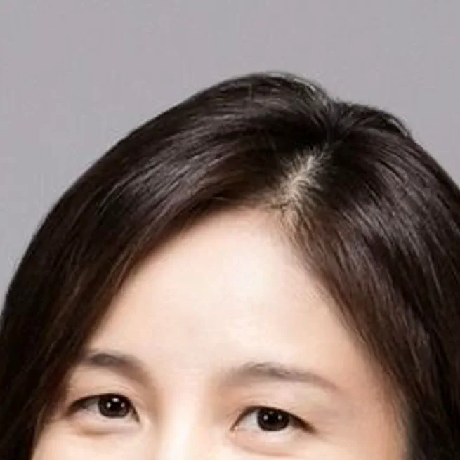 [칼럼] ‘컬러렌즈’ 건강하게 착용하는 요령