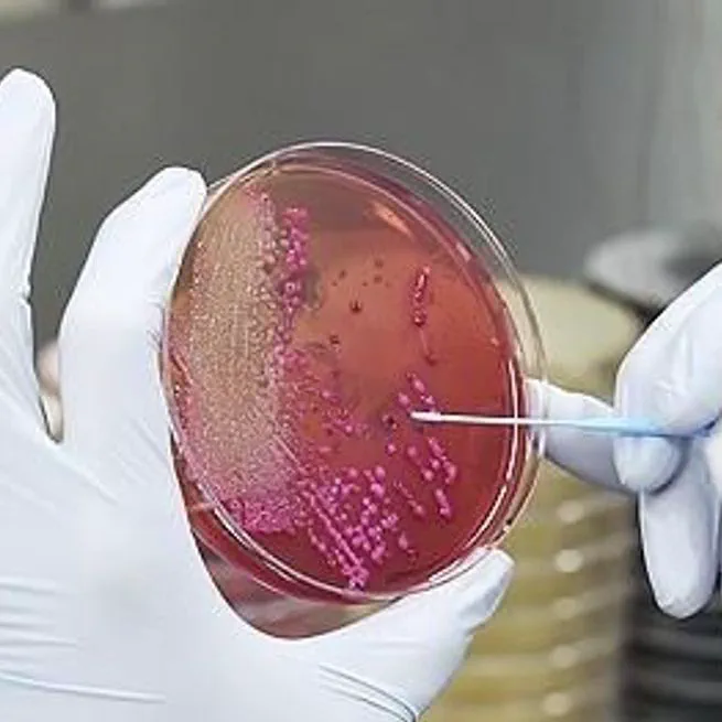 횡성군, 식중독 예방 만전…맞춤형 위생 컨설팅·수거검사